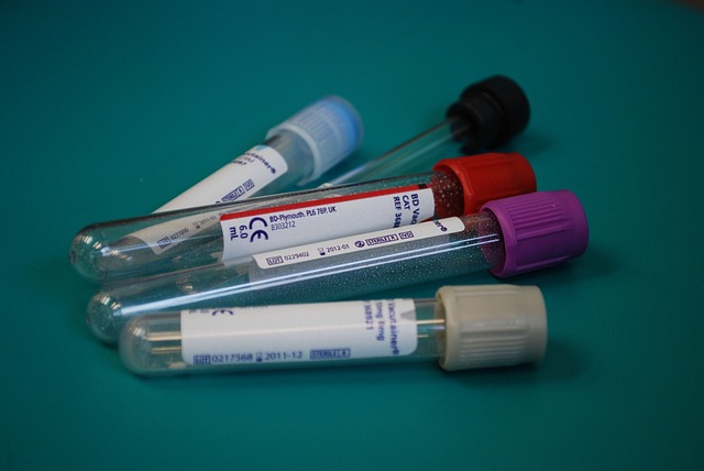 asbestos-testing-640x480-96288100.jpeg