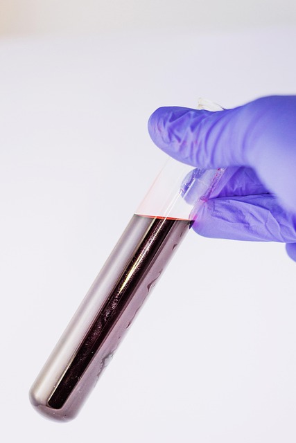 Asbestos Testing